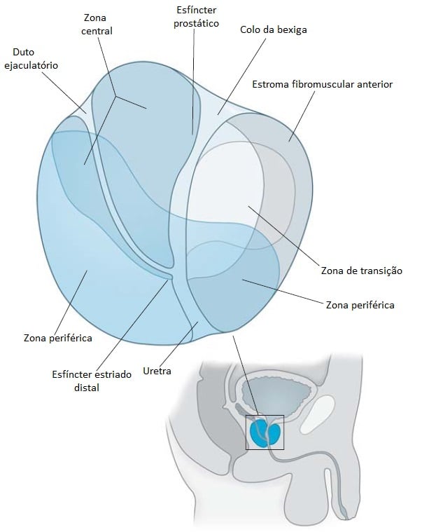 Sintomas do Câncer de Próstata