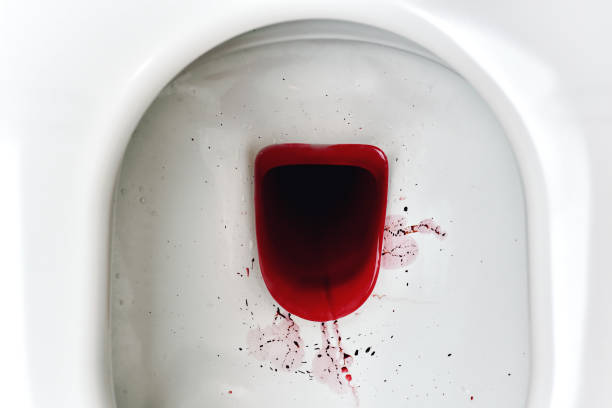 Consulta urológica sobre sangue na urina com urologista em Atibaia
